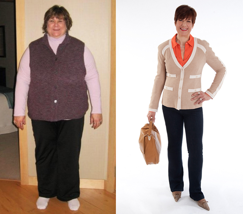 Lori Schaefer Before & After 200 Pound Weight Loss